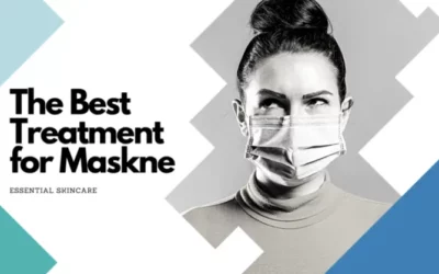 WHAT IS THE BEST TREATMENT FOR MASKNE AND ACNE?