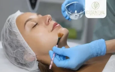 Facials vs. Chemical Peels: Which Is More Effective for Skin Improvement?
