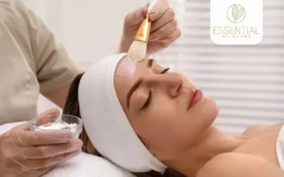 Chemical Peels and Their Impact on Skin Elasticity